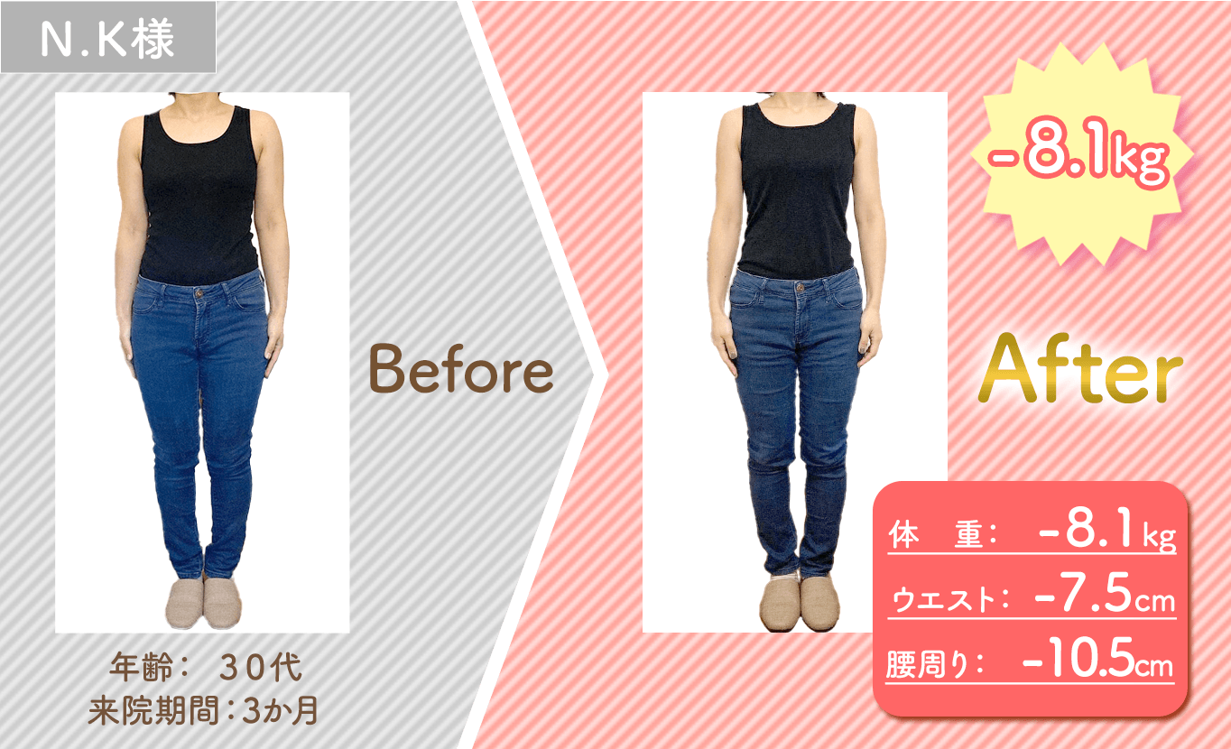 来院期間3ヶ月の30代女性。体重-8.1kg、ウエスト-7.5cm、腰周りり-10.5cm